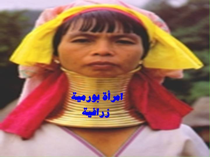 المرأة الزرافة